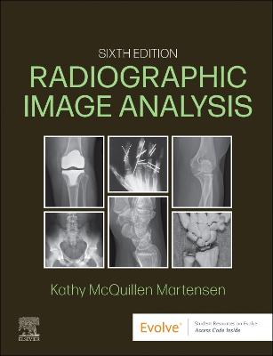 Radiographic Image Analysis